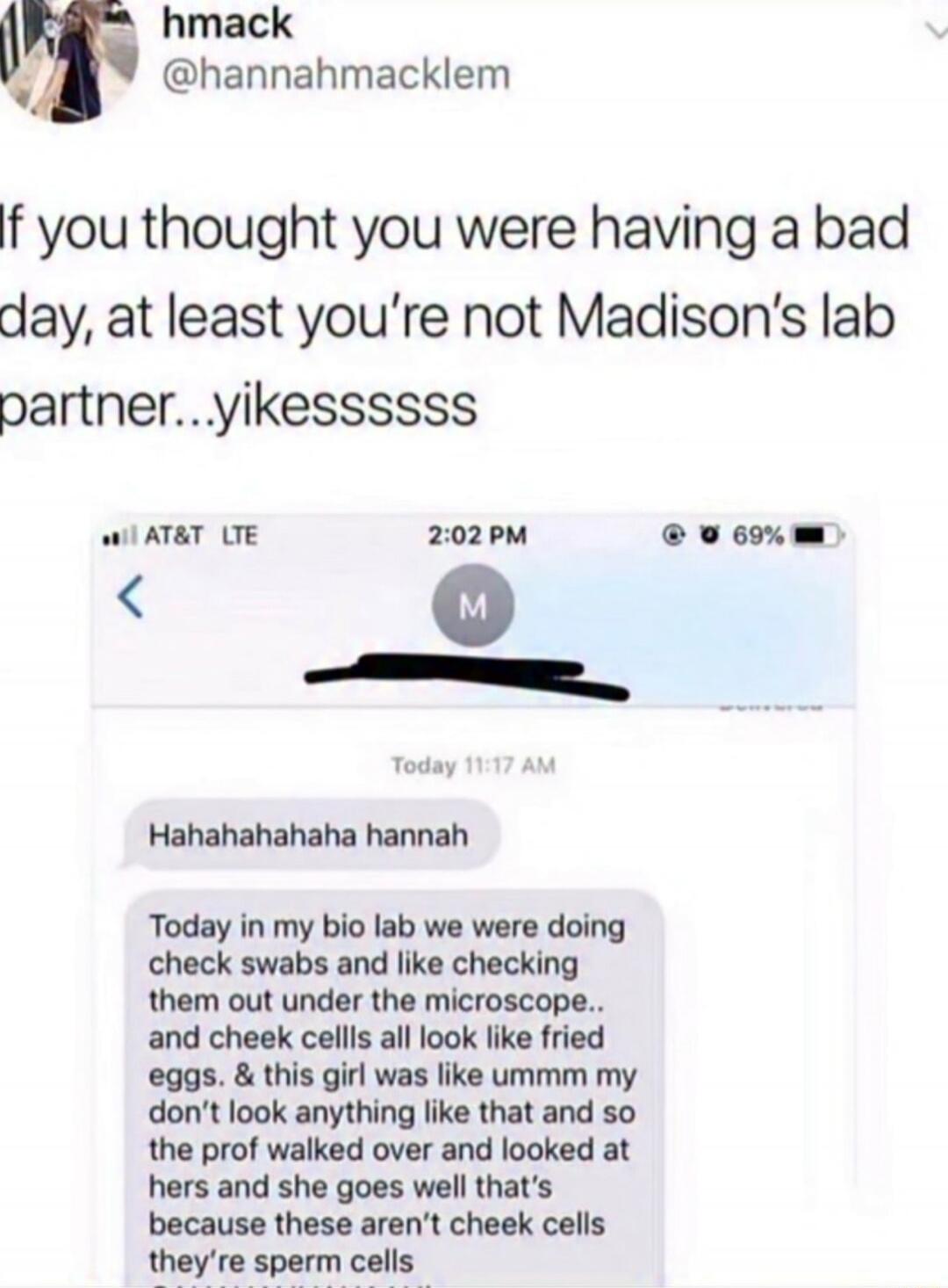 hmack @hannahmacklem If you thought you were having a bad day, at least you're not Madison's lab partner...yikessssss Hahahahahaha hannah Today in my bio lab we were doing check swabs and like checking them out under the microscope.. and cheek cells all look like fried eggs. & this girl was like ummm my don't look anything like that and so the prof
