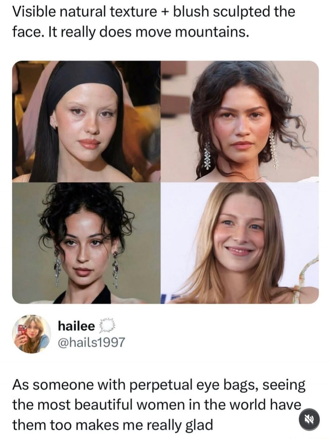 Visible natural texture + blush sculpted the face. It really does move mountains. As someone with perpetual eye bags, seeing the most beautiful women in the world have them too makes me really glad.