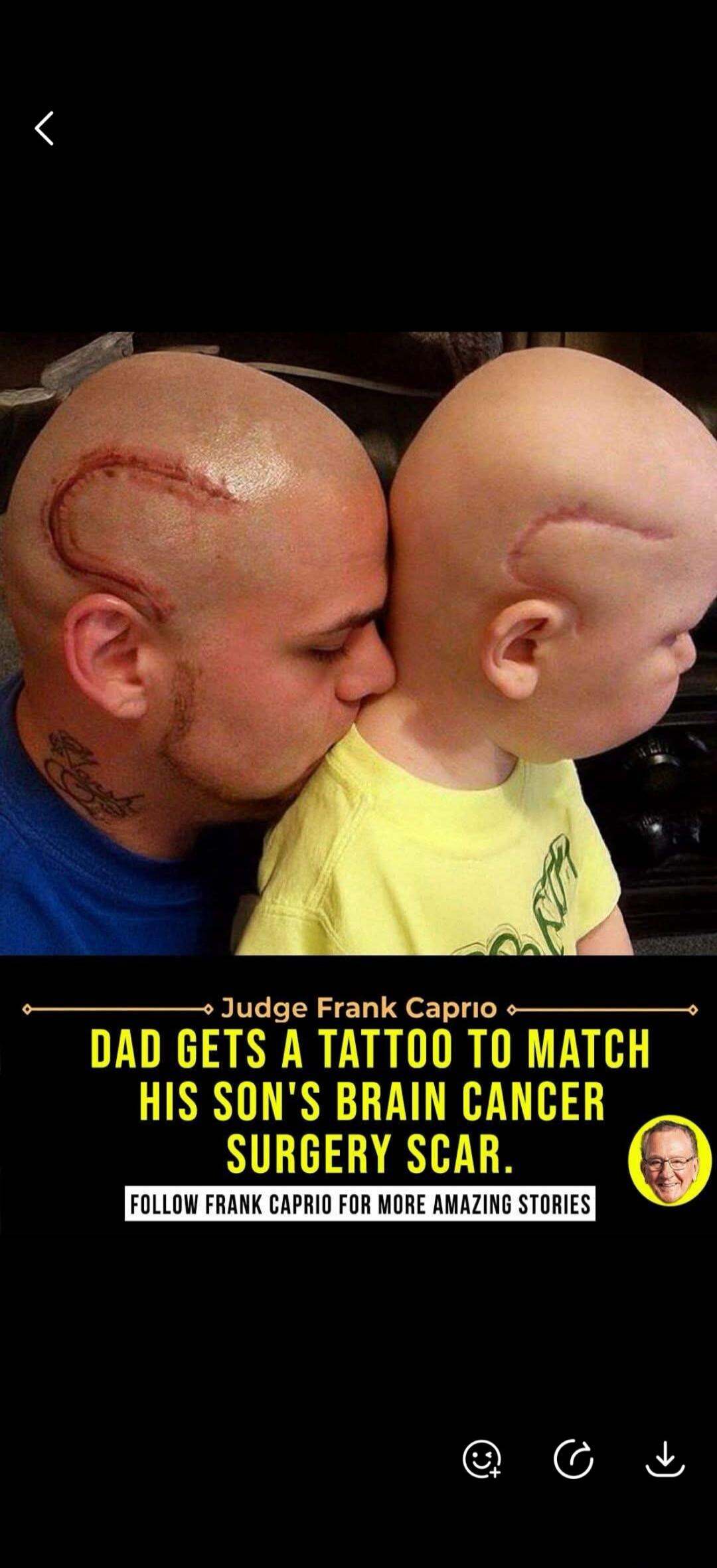 Judge Frank Caprio DAD GETS A TATTOO TO MATCH HIS SON'S BRAIN CANCER SURGERY SCAR. FOLLOW FRANK CAPRIO FOR MORE AMAZING STORIES. The image shows a father with a tattoo on his head mirroring his son's surgical scar, both having shaved heads.