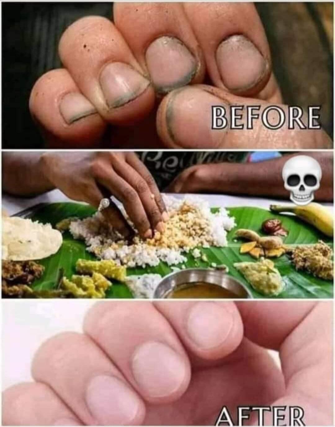 BEFORE AFTER. A person is shown eating food with their hands from a banana leaf. The meme implies that eating with dirty hands cleans the nails, but it's presented as unhygienic or disgusting.
