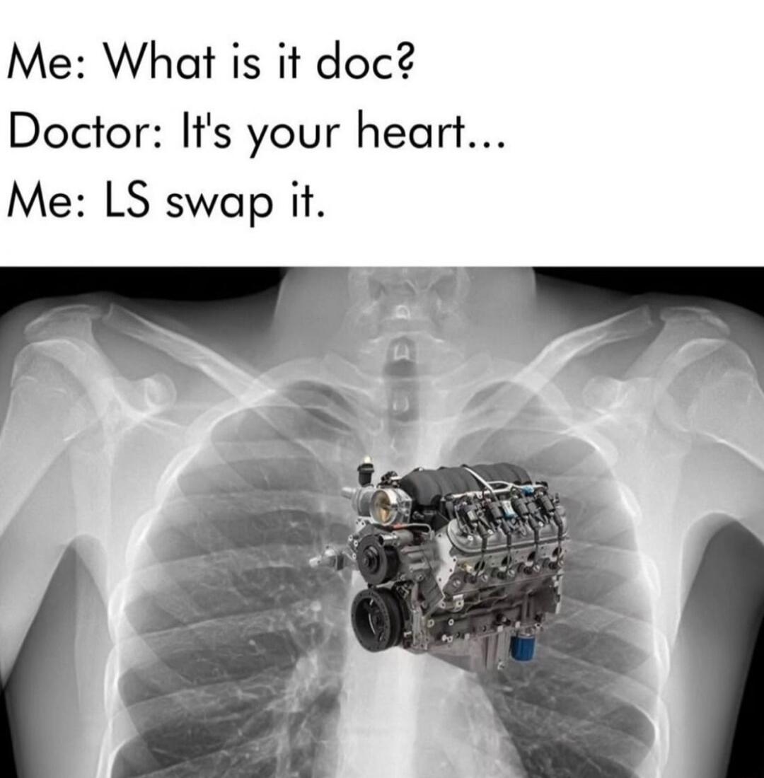 Me What is it doc Doctor Its your heart Me LS swap it