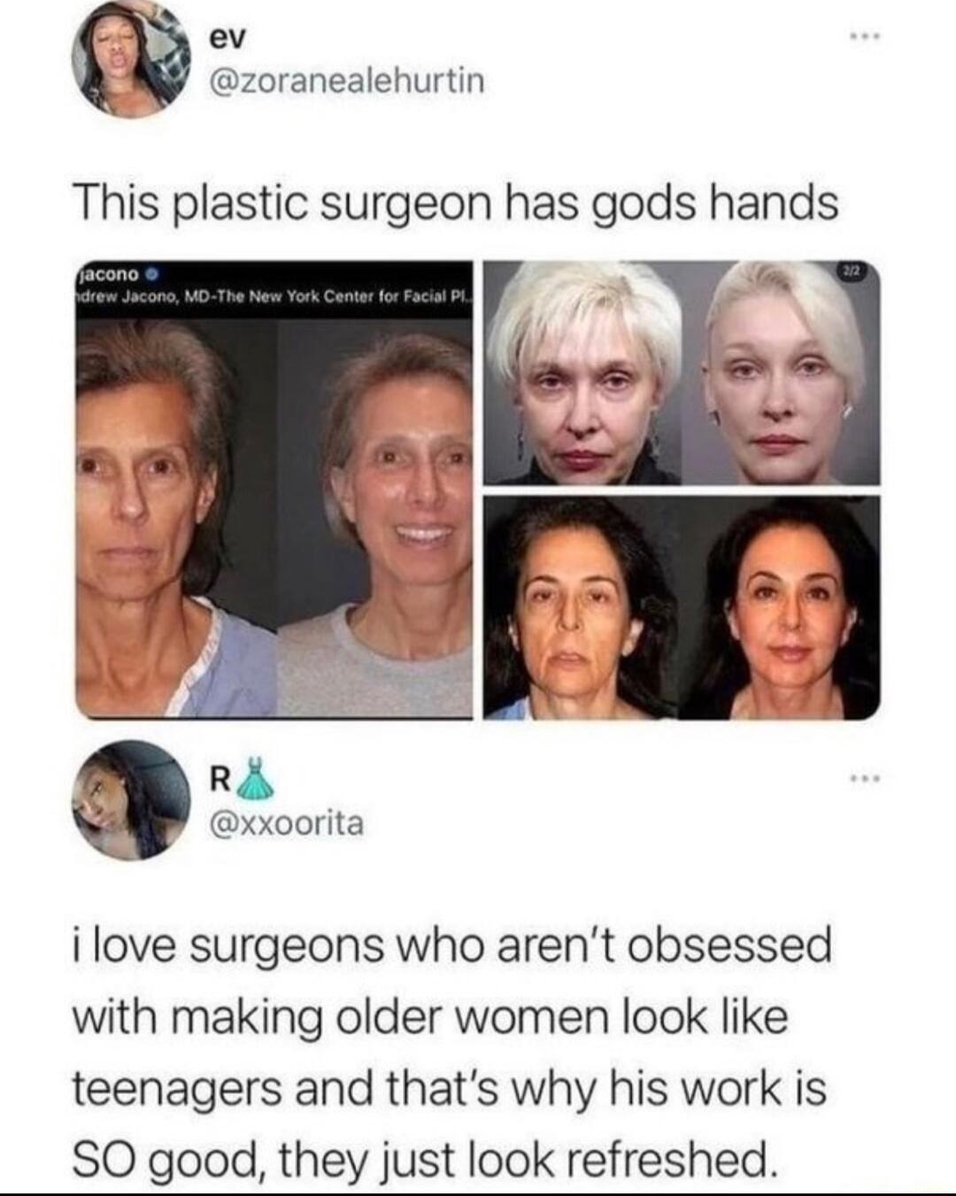 ev zoranealehurtin This plastic surgeon has gods hands R xxoorita i love surgeons who arent obsessed with making older women look like teenagers and thats why his work is SO good they just look refreshed