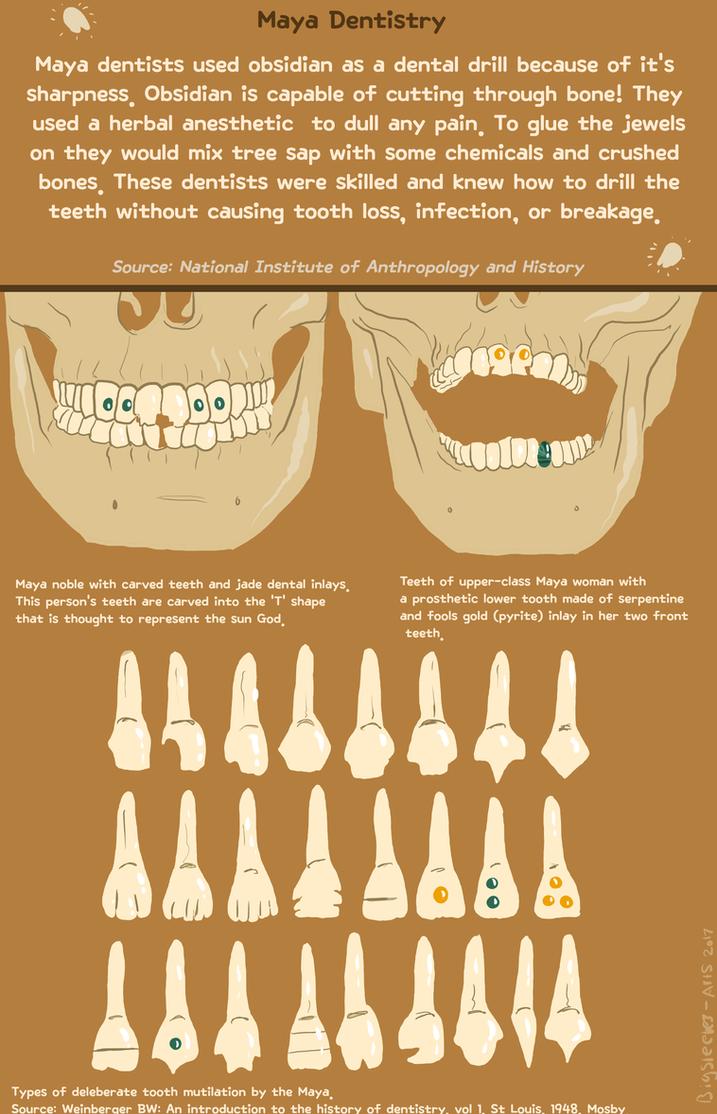 Maya dentists used obsidian as a dental drill because of its Sharpness Obsidian is capable of cutting through bonel They used a herbal anesthetic to dull any pain To glue the jewels on they would mix tree Sap with Some chemicals and crushed bones These dentists were skilled and knew how to drill the teeth without causing tooth loss infection or breakag Source National Institute of Anthropology and