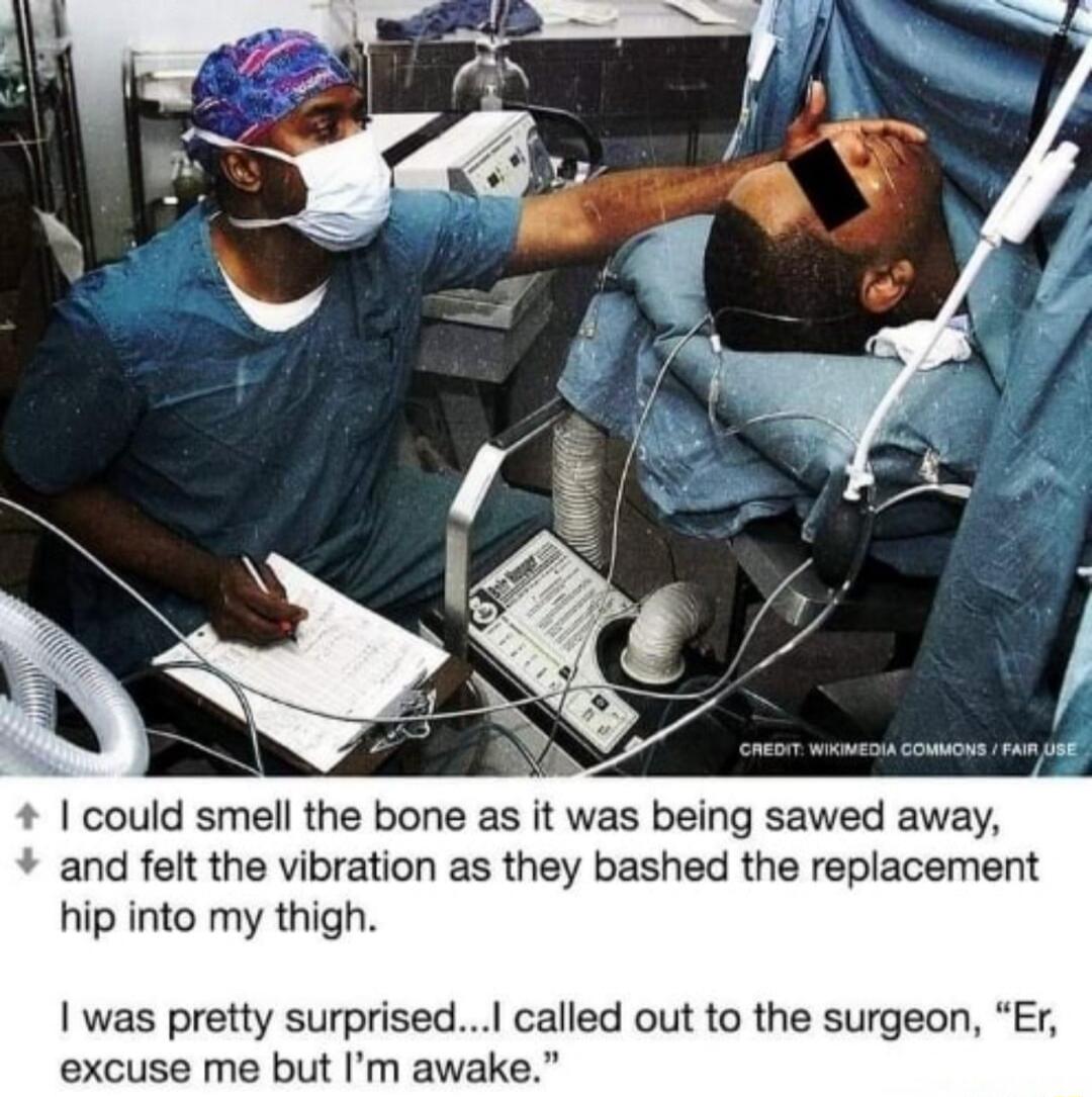 could smell the bone as it was being sawed away and felt the vibration as they bashed the replacement hip into my thigh was pretty surprised called out to the surgeon Er excuse me but Im awake