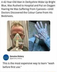 A 42-Year-Old Man in Derbyshire Woke Up Bright Blue, Was Rushed to Hospital and Put on Oxygen Fearing He Was Suffering From Cyanosis—Until Doctors Discovered the Colour Came From His Bedsheets. Genuine History @genuine_history This is the most expensive way to learn 