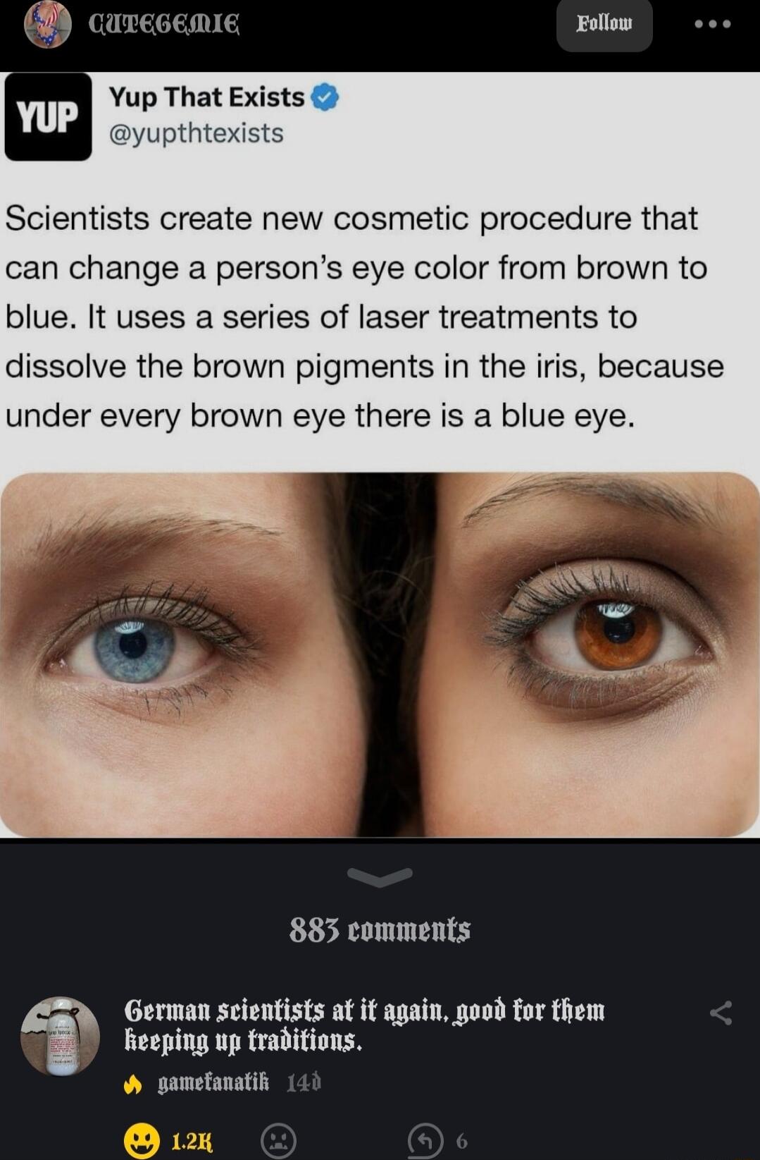 carecemie Bollow oo Yup That Exists Scientists create new cosmetic procedure that can change a persons eye color from brown to blue It uses a series of laser treatments to dissolve the brown pigments in the iris because under every brown eye there is a blue eye LAY 883 comments German scientists at it again good for them Feeping up traditions pametanatif