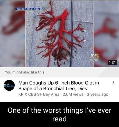 Man Coughs Up 6 Inch Blood Clot in Shape of a Bronchial Tree Dies One of the worst things Ive ever CEL