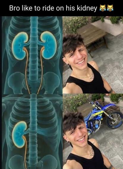 Bro like to ride on his kidney 😂😂😂