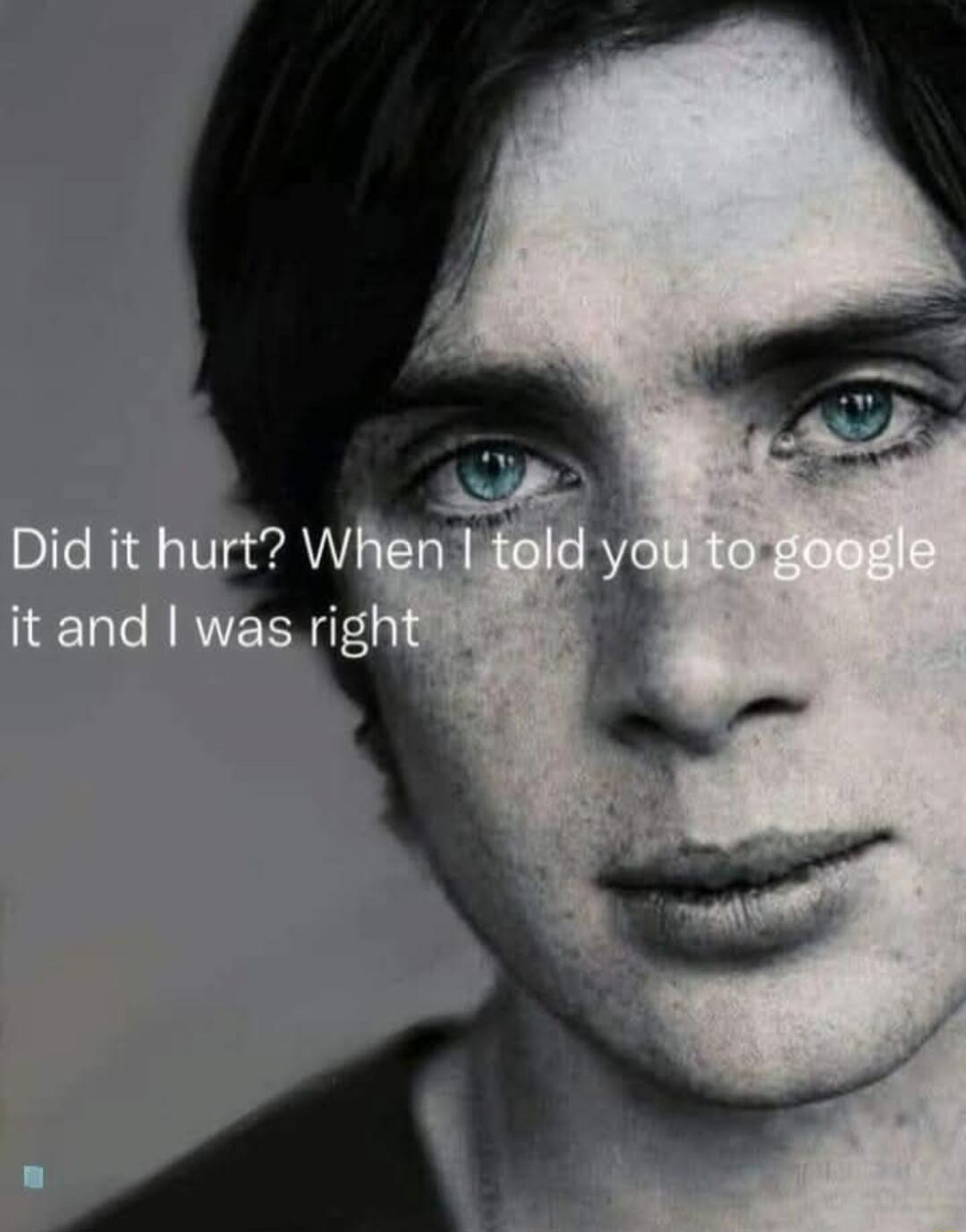 Did it hurt? When I told you to google it and I was right