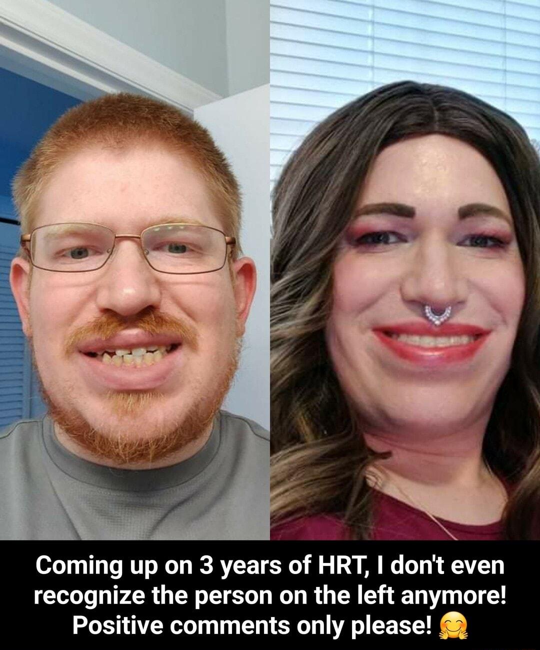 Coming up on 3 years of HRT dont even recognize the person on the left anymore Positive comments only please