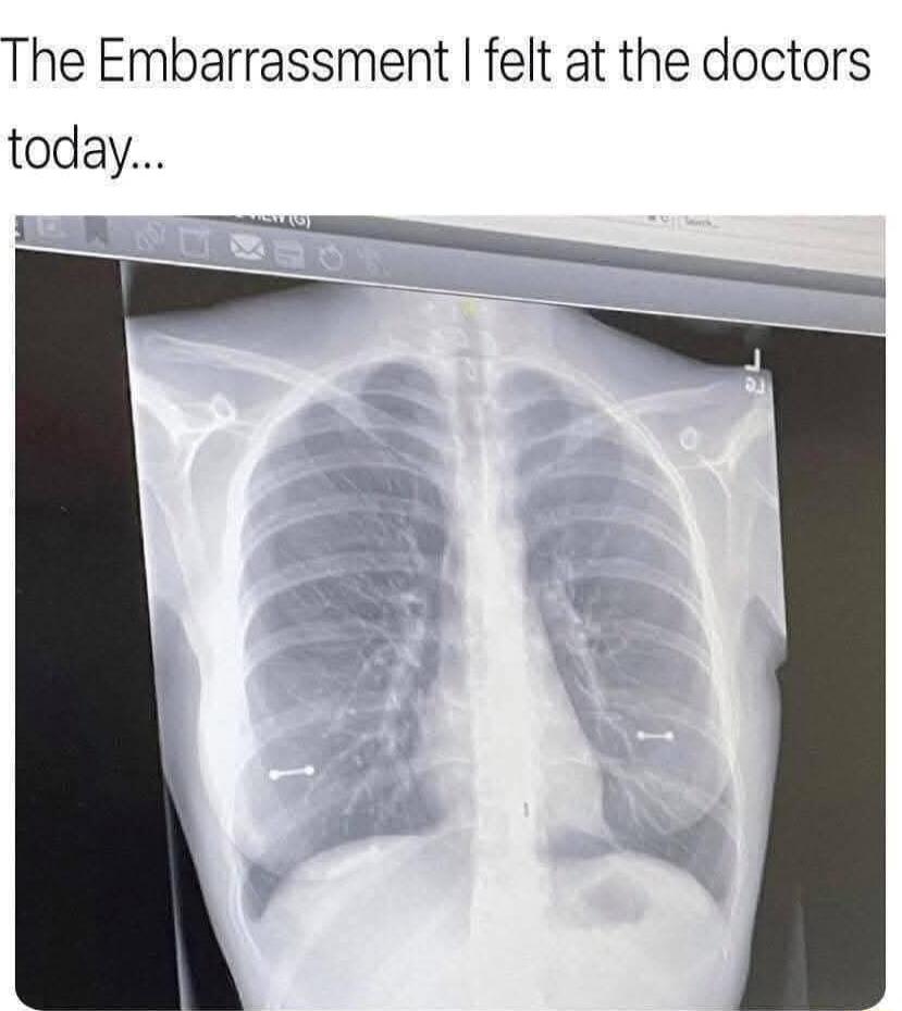 The Embarrassment felt at the doctors today
