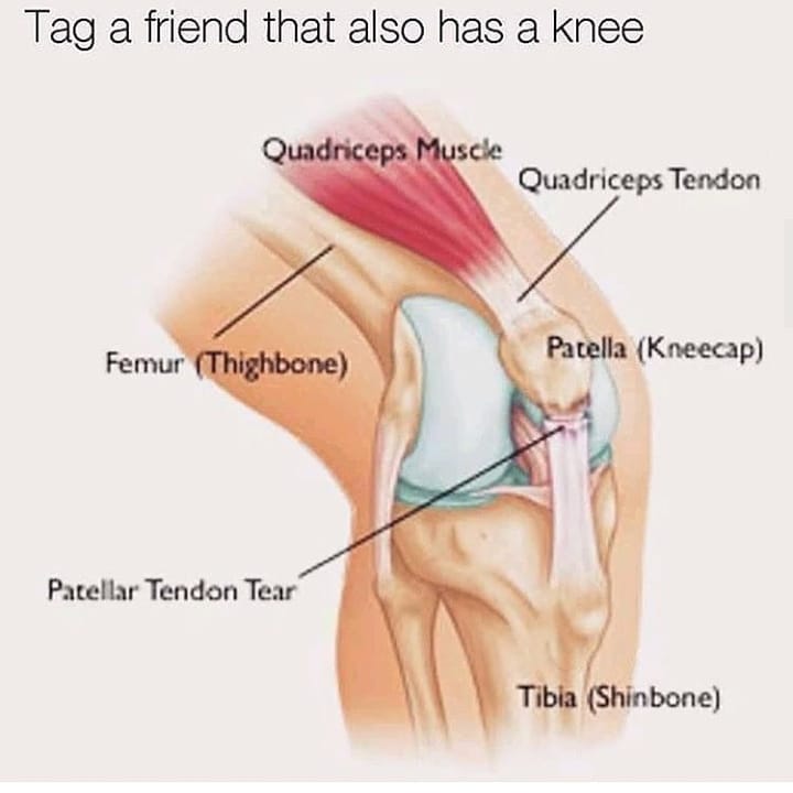 Tag a friend that also has a knee