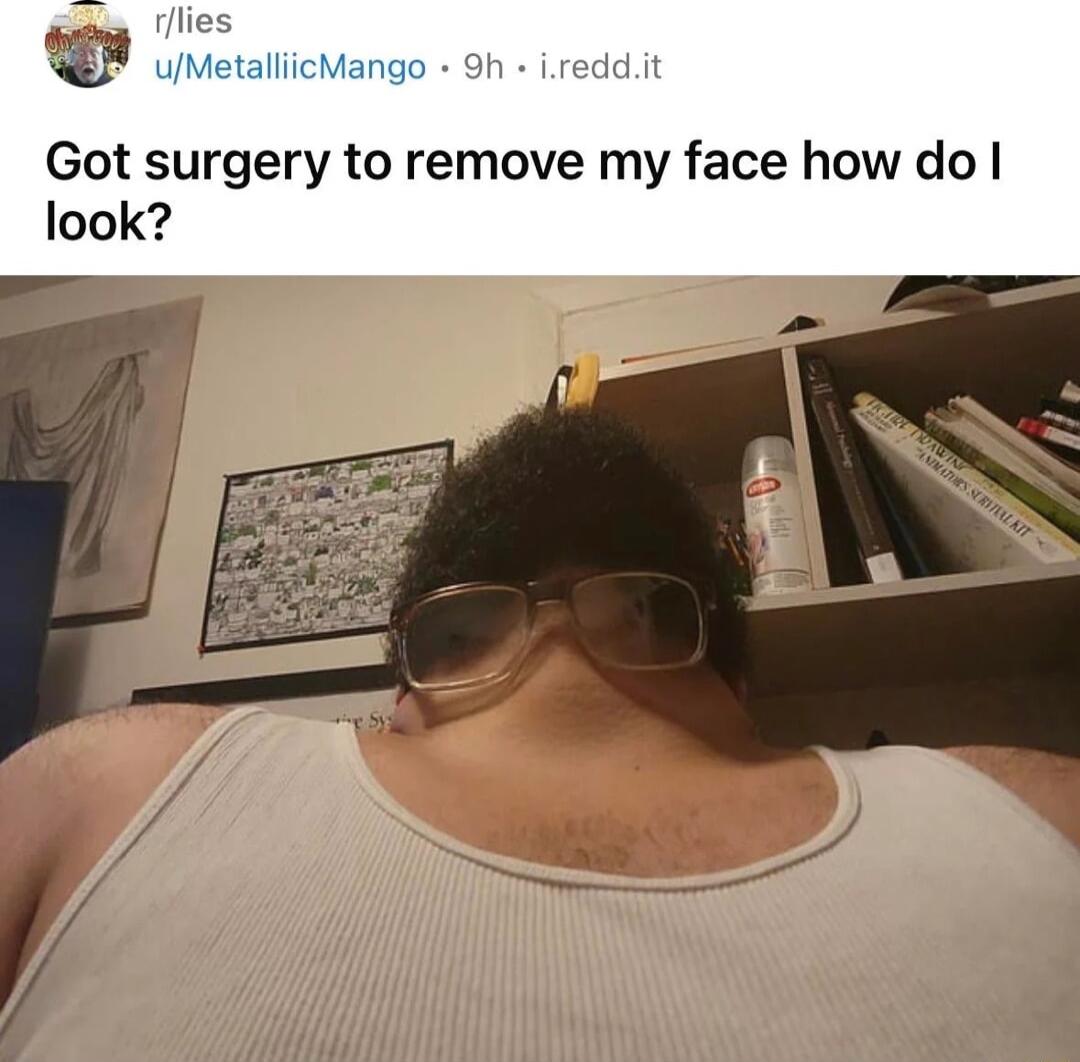 rflies w uMetaliicMa Got surgery to remove my face how do look