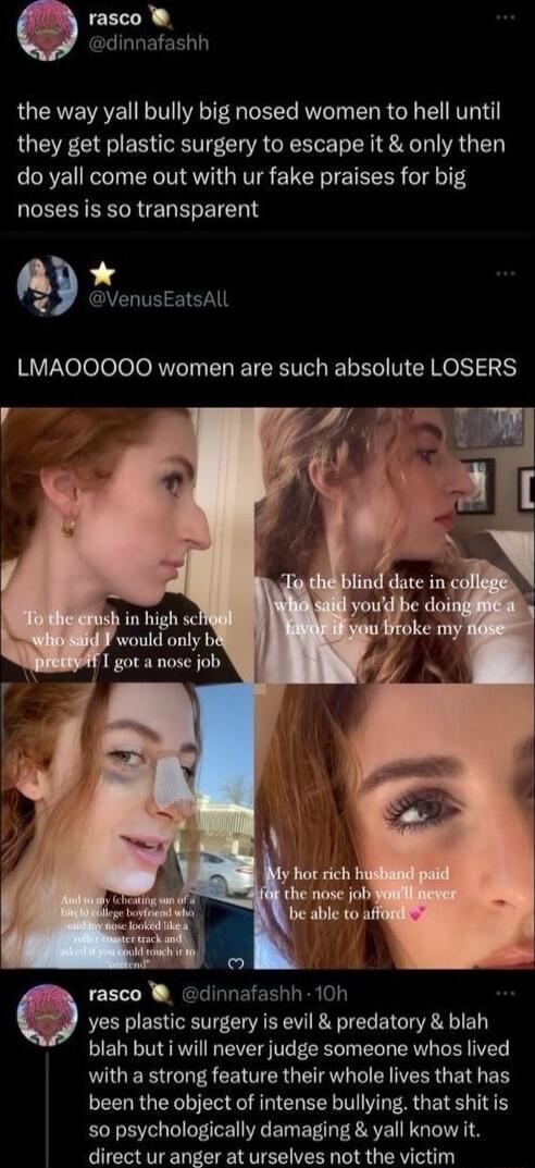 rasco GLIGDEIEE L the way yall bully big nosed women to hell until they get plastic surgery to escape it only then do yall come out with ur fake praises for big noses is so transparent VenusEatsAll LMAOOOOO women are such absolute LOSERS rasco W dinnafashh 10h yes plastic surgery is evil predatory blah blah but i will never judge someone whos lived LUERGIES CEVERG RN R IR EIER been the object of i