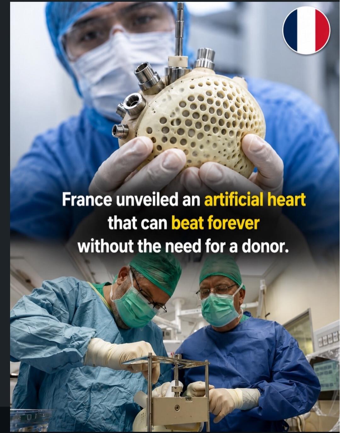 France unveiled an artificial heart that can beat forever without the need for a donor.