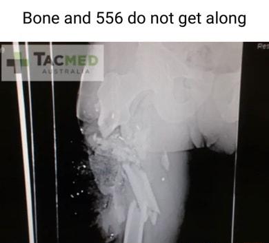 Bone and 556 do not get along nh TACME ALSTRAL
