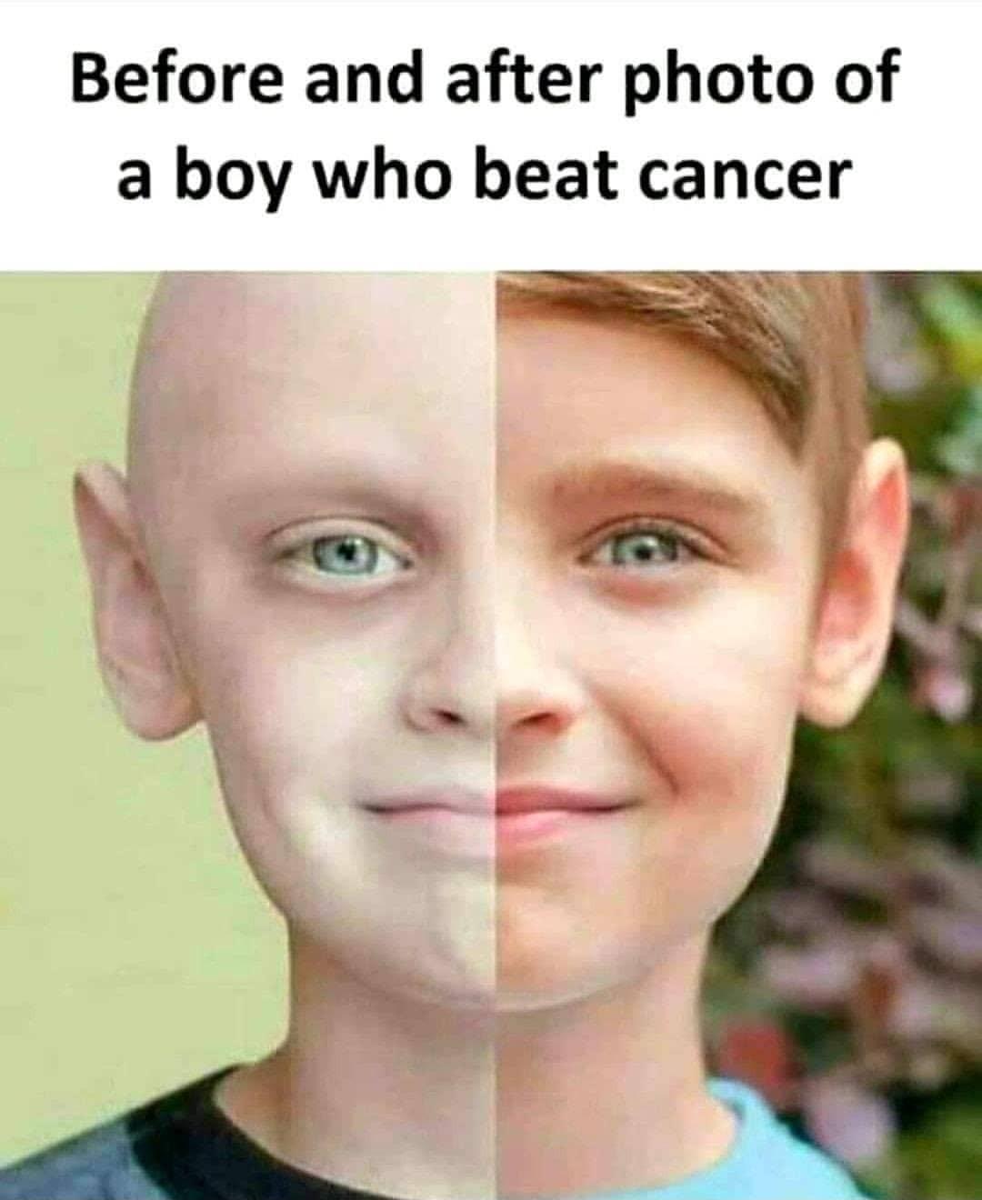 Before and after photo of a boy who beat cancer