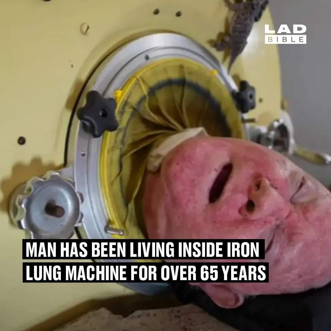 O MAN HAS BEEN LIVING INSIDE IRON LUNG MACHINE FOR OVER BEYEARS