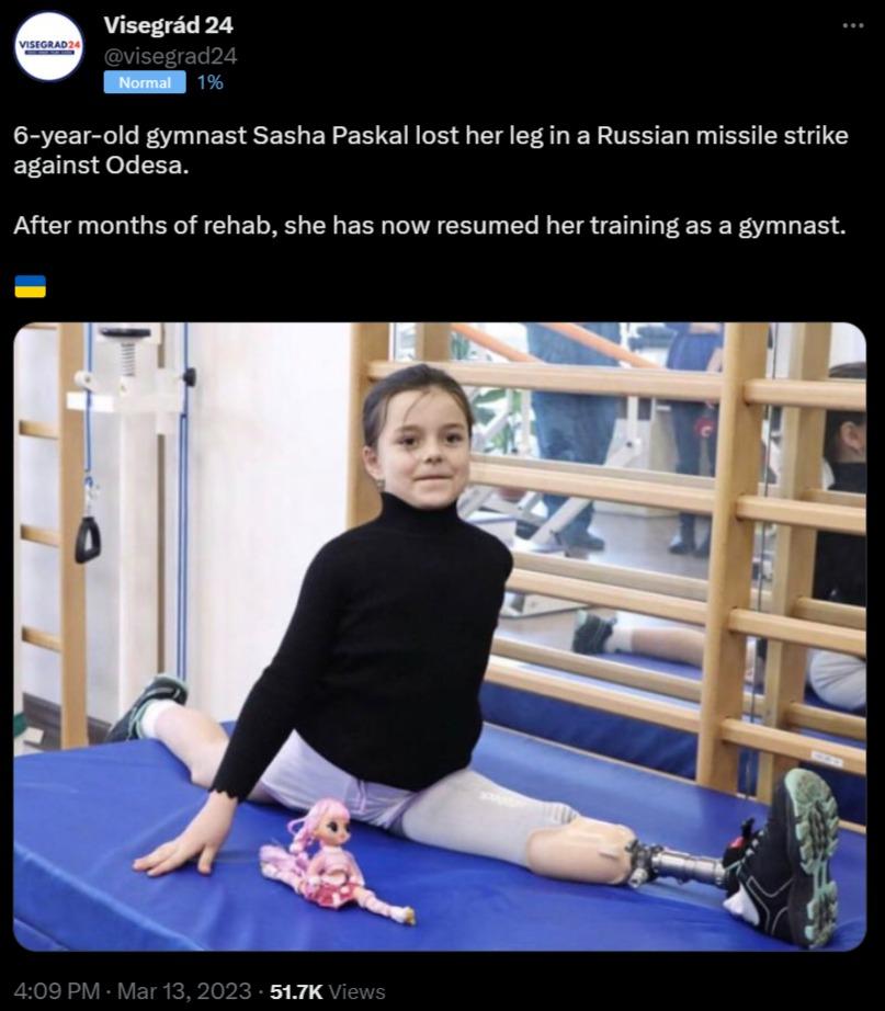 6 year old gymnast Sasha Paskal lost her leg in a Russian missile strike PrATET After months of rehab she has now resumed her training as a gymnast s