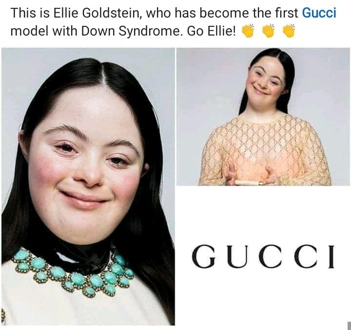 This is Ellie Goldstein who has become the first Gucci model with Down Syndrome Go Ellie