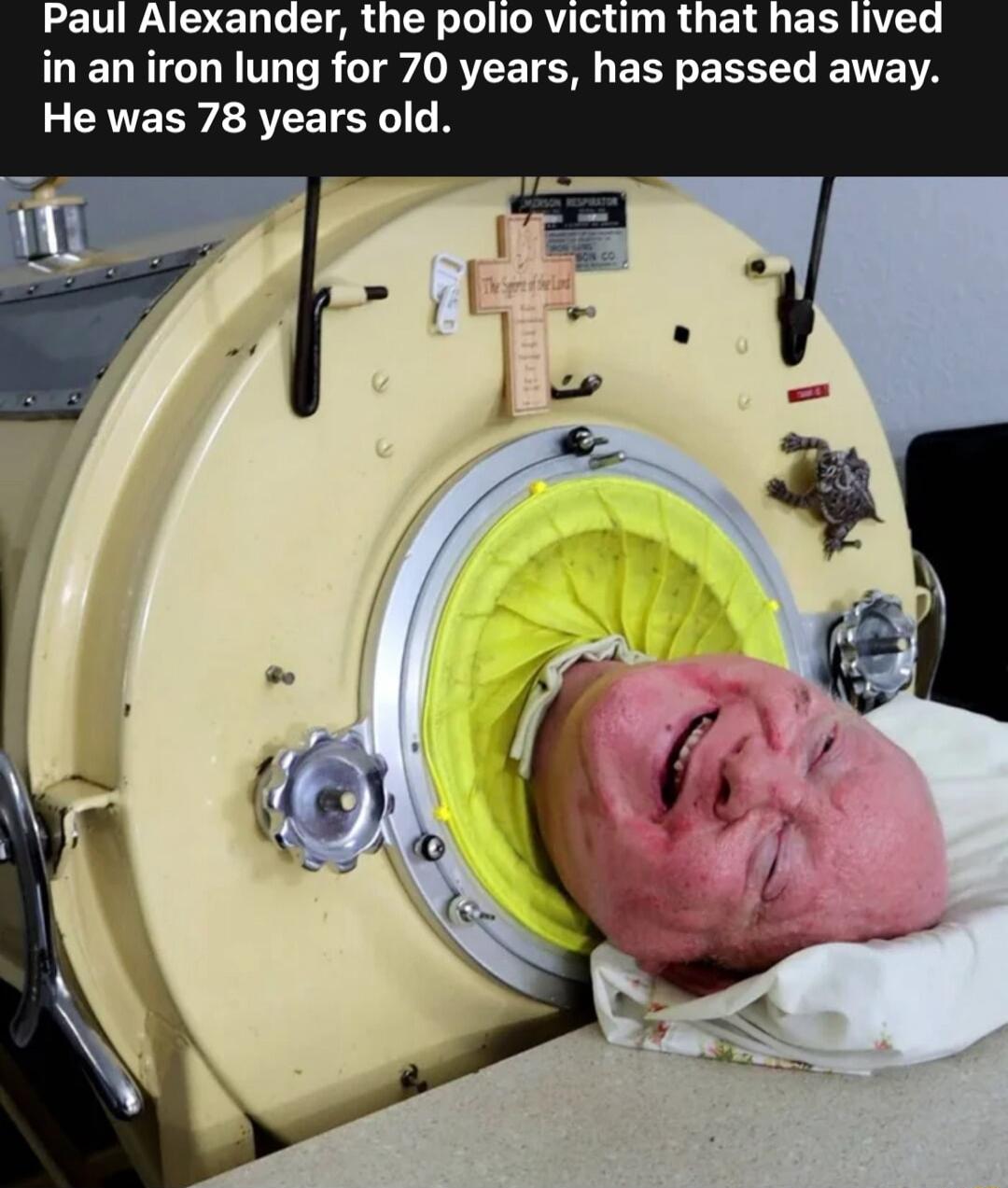 LENEND E N ARG LR O DRI RUETI ERR TN in an iron lung for 70 years has passed away He was 78 years old