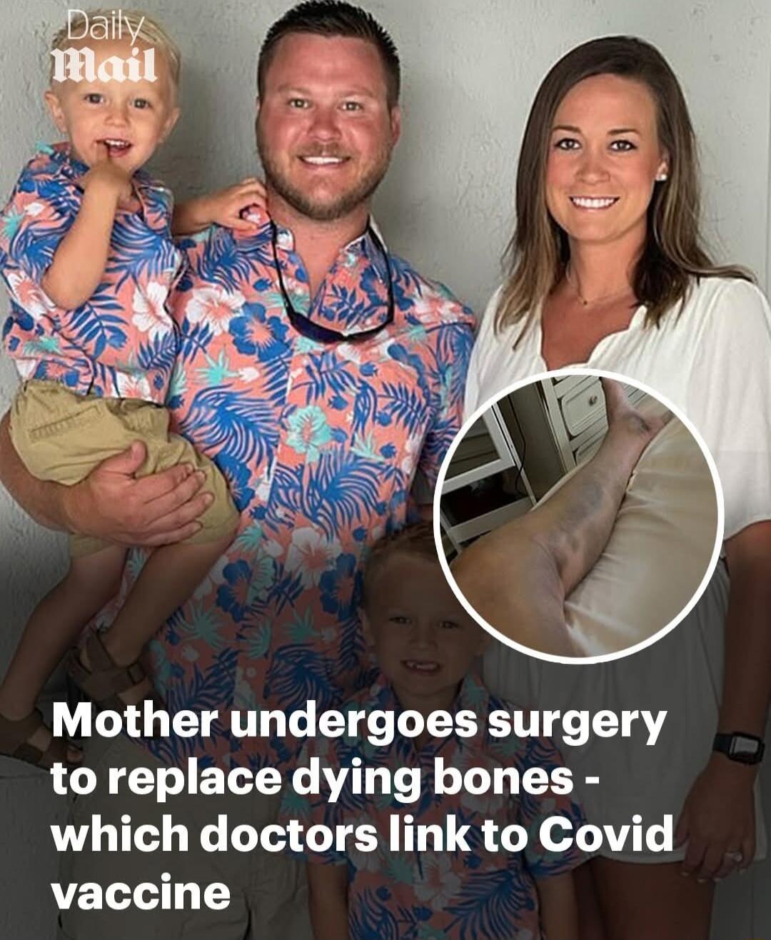 Mother undergoes surgery to replace dying bones which doctors link to Covid vaccine