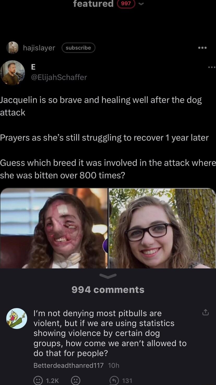 Teatured 7 B haiisiayer subscrive F ElijahSchaffer Jacquelin is so brave and healing well after the dog attack Prayers as shes still struggling to recover 1 year later Guess which breed it was involved in the attack where she was bitten over 800 times 994 comments Im not denying most pitbulls are violent but if we are using statistics showing violence by certain dog groups how come we arent allowe