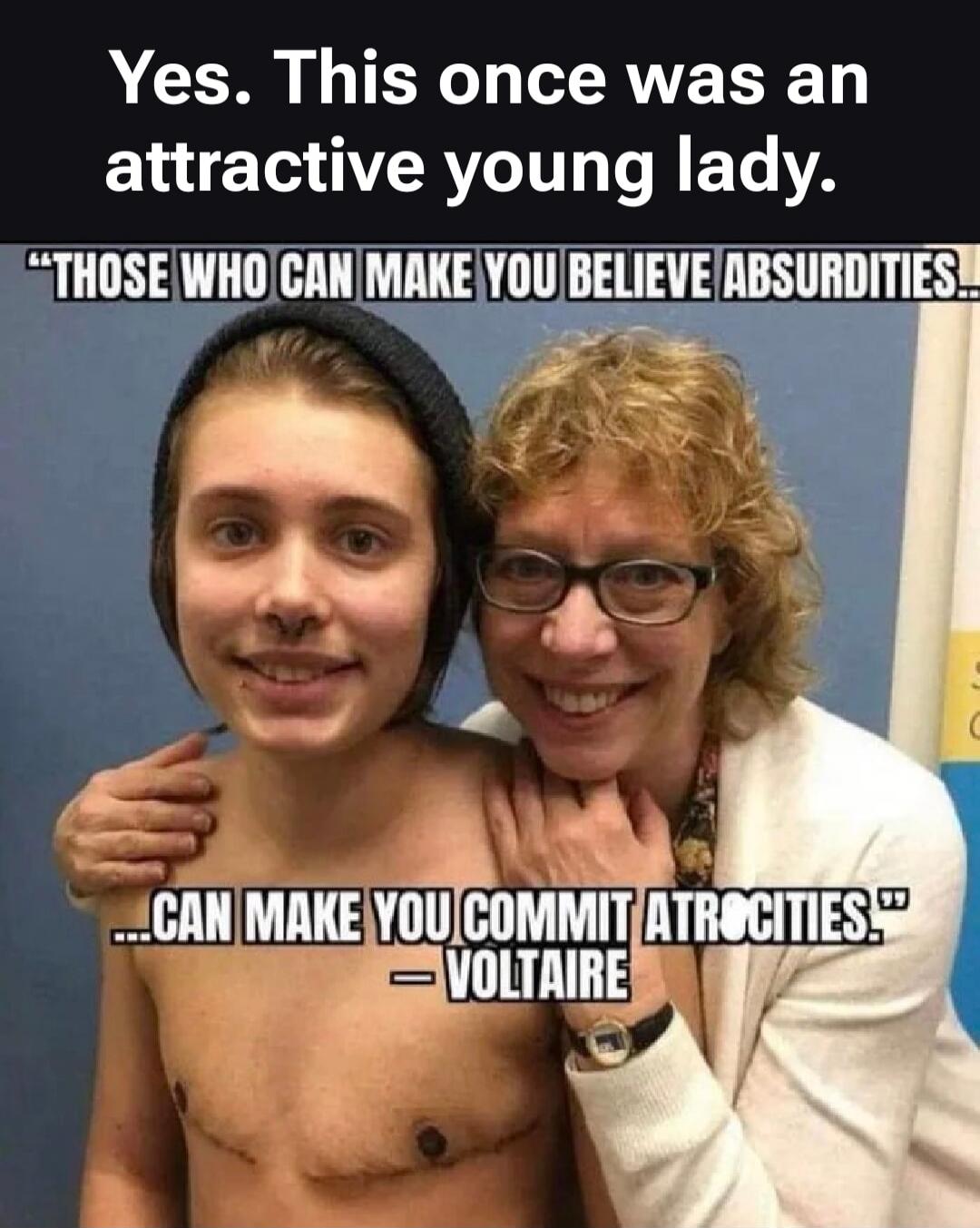 Yes. This once was an attractive young lady. 