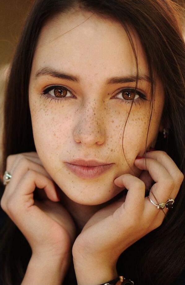 A close-up portrait of a young woman with freckles, resting her chin on her hands.