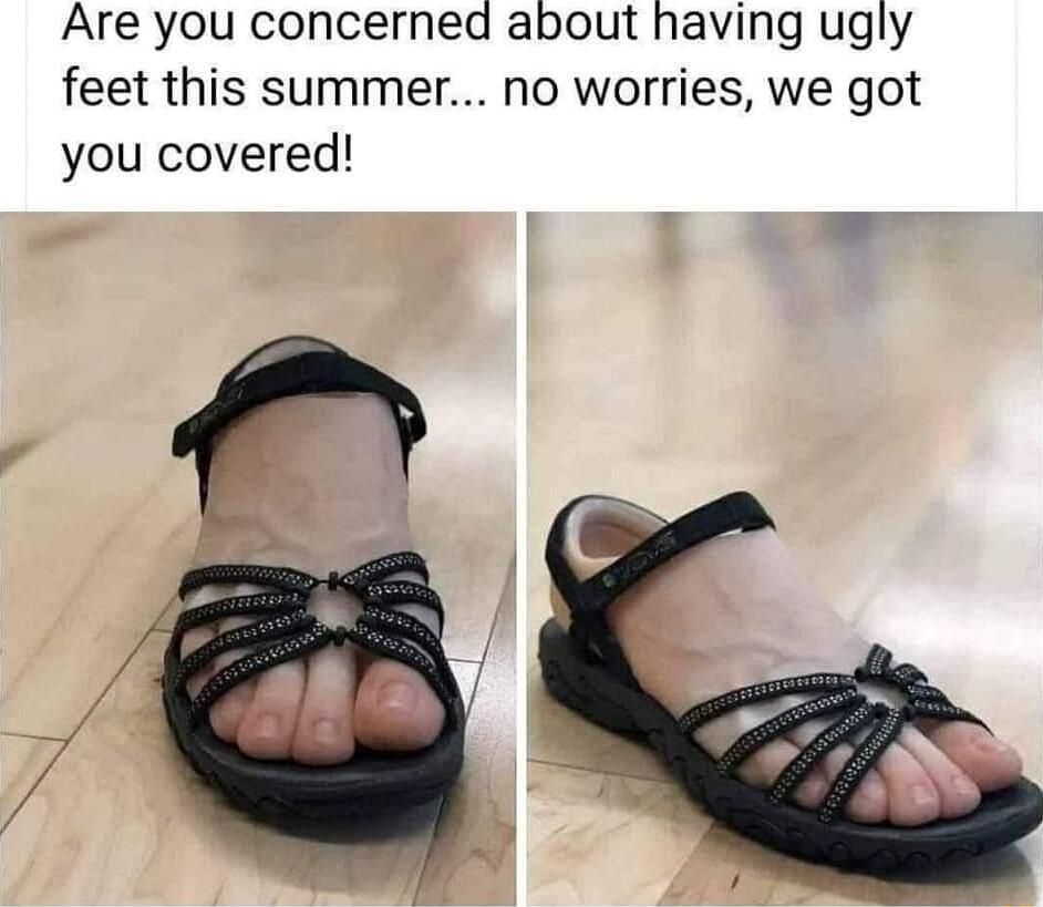 Are you concerned about having ugly feet this summer no worries we got you covered