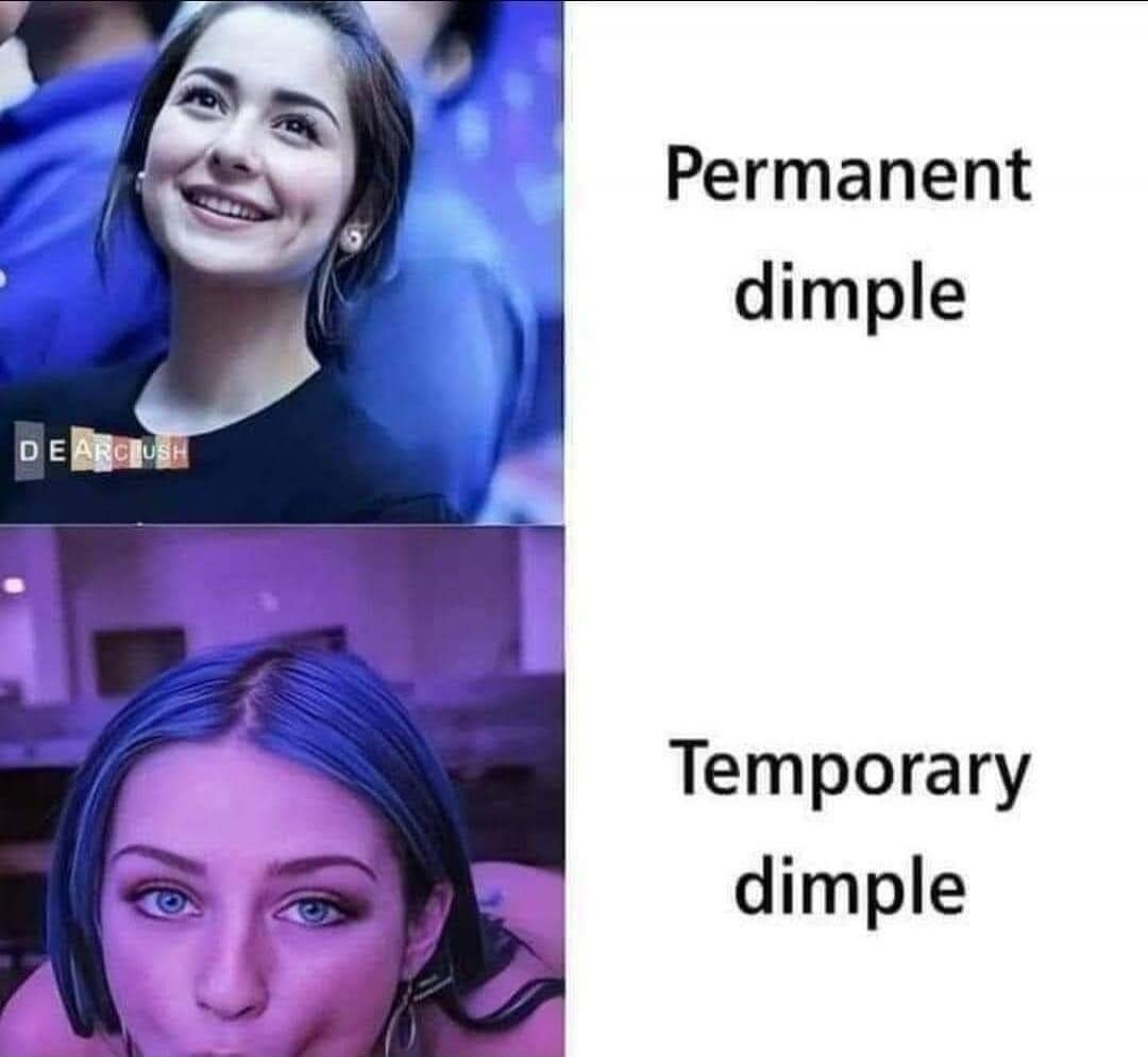 Permanent dimple
Temporary dimple
