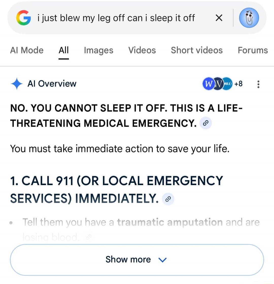 NO. YOU CANNOT SLEEP IT OFF. THIS IS A LIFE-THREATENING MEDICAL EMERGENCY. You must take immediate action to save your life. 1. CALL 911 (OR LOCAL EMERGENCY SERVICES) IMMEDIATELY. Tell them you have a traumatic amputation and are losing blood.