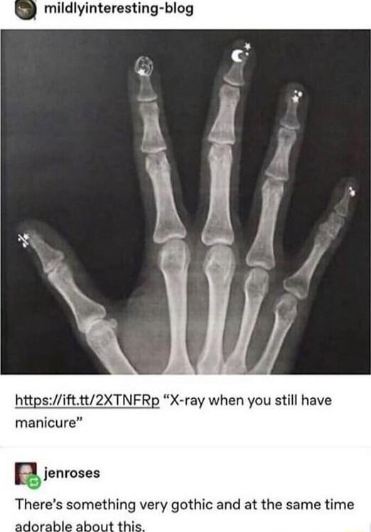 httpsifttt2XTNFRp X ray when you still have manicure R fenroses Theres something very gothic and at the same time