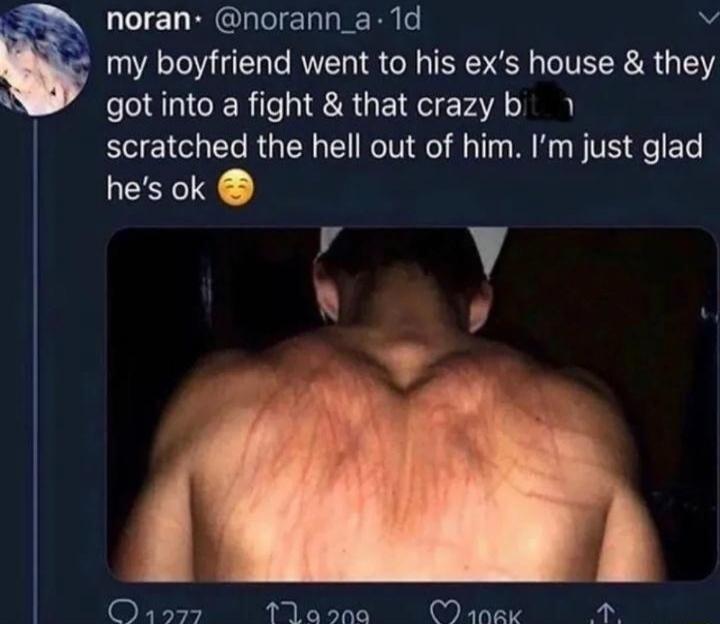 my boyfriend went to his ex's house & they got into a fight & that crazy b scratched the hell out of him. I’m just glad he's ok 😌
