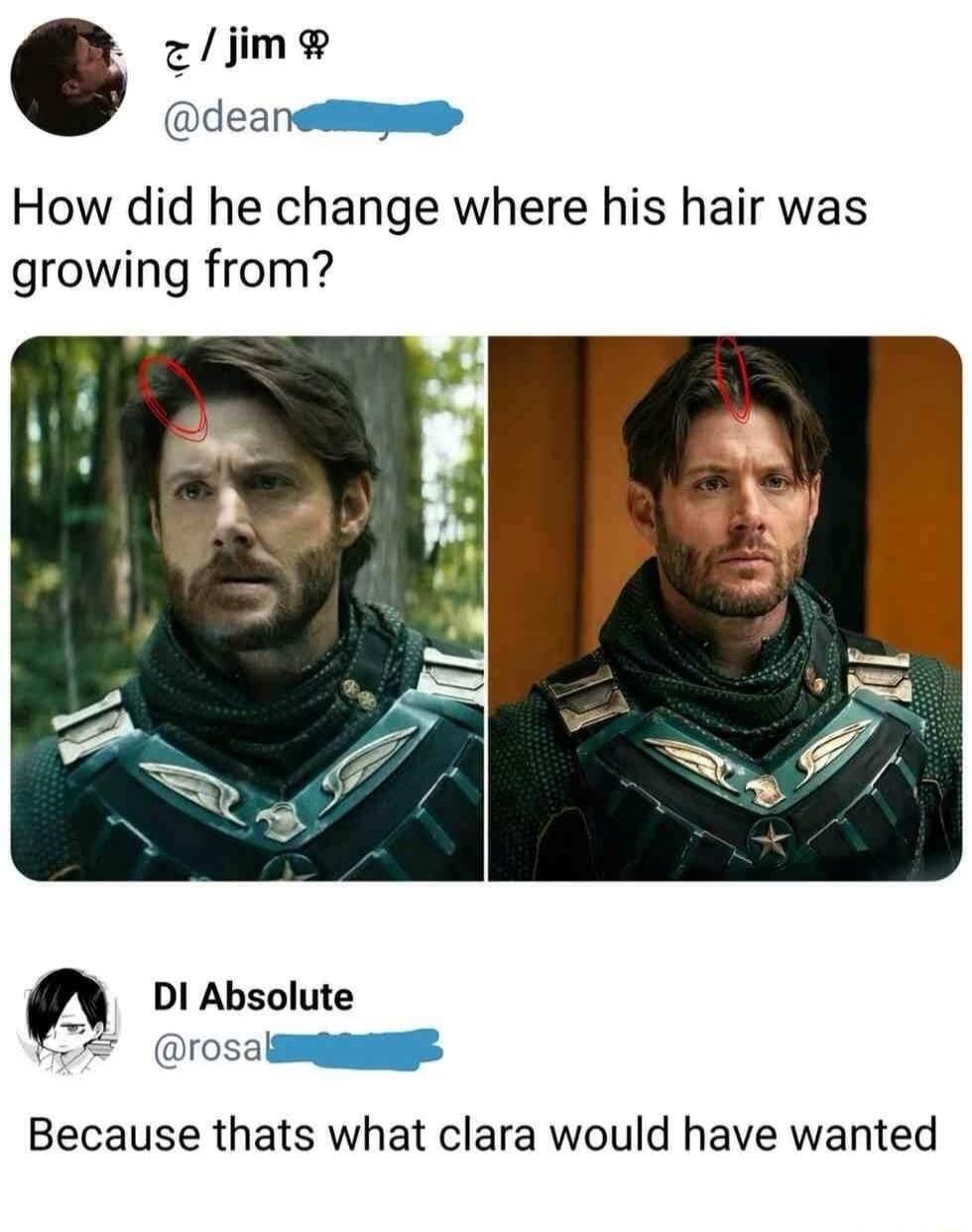 How did he change where his hair was growing from? Because thats what clara would have wanted