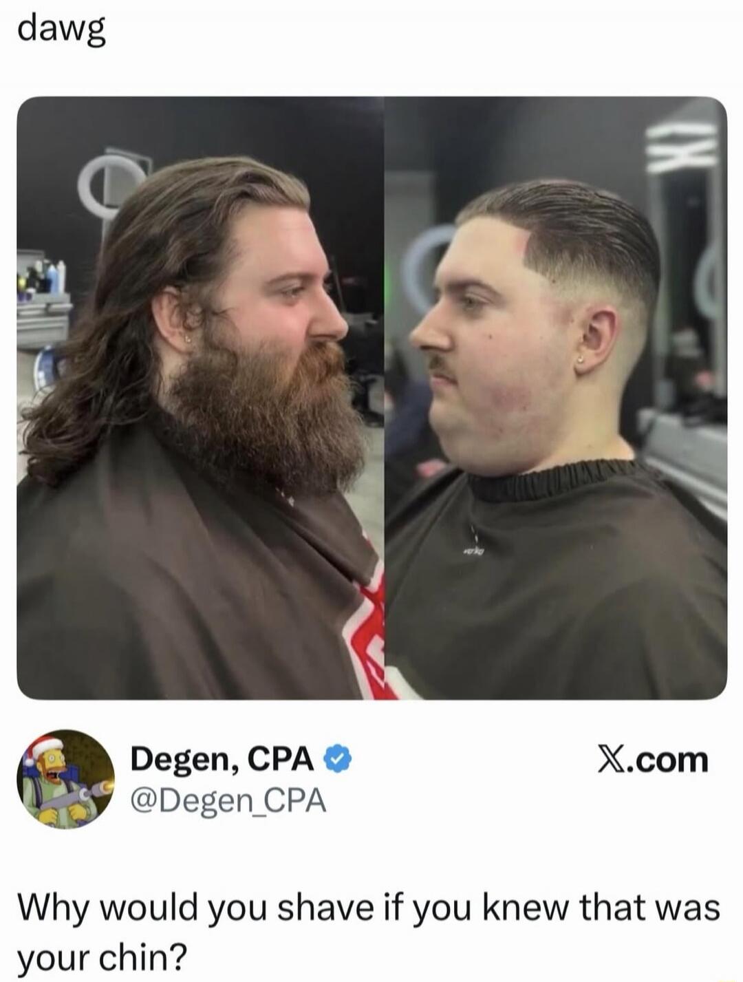 dawg

Why would you shave if you knew that was your chin?