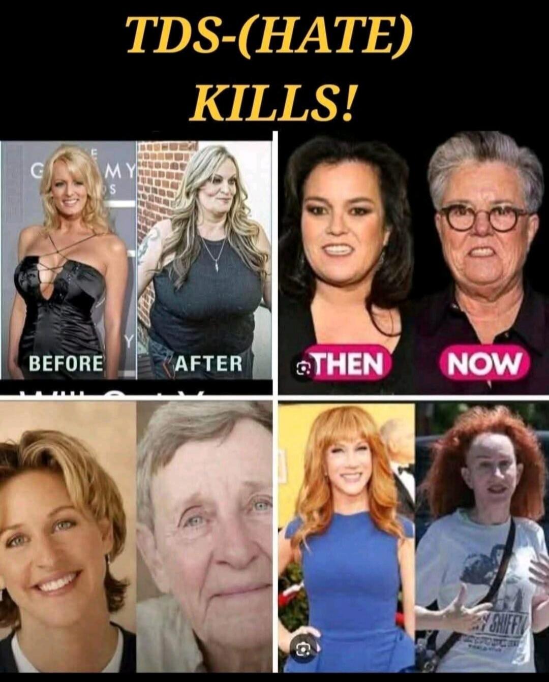TDS-(HATE) KILLS! BEFORE AFTER THEN NOW