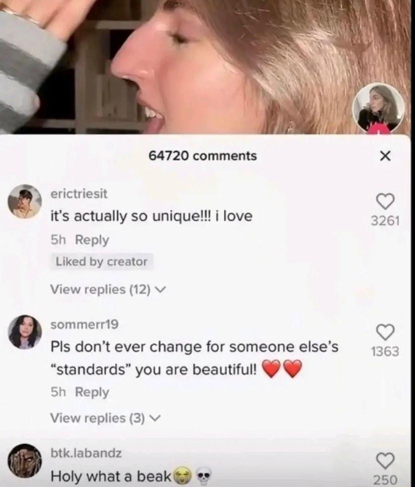 64720 comments e its actually so uniquelll i love Reply Liked by creator View replies 12 v sommerr19 9 Pis dont ever change for someone elses standards you are beautifull 5h Reply View replies 3 v btk labandz Holy what a beak 250