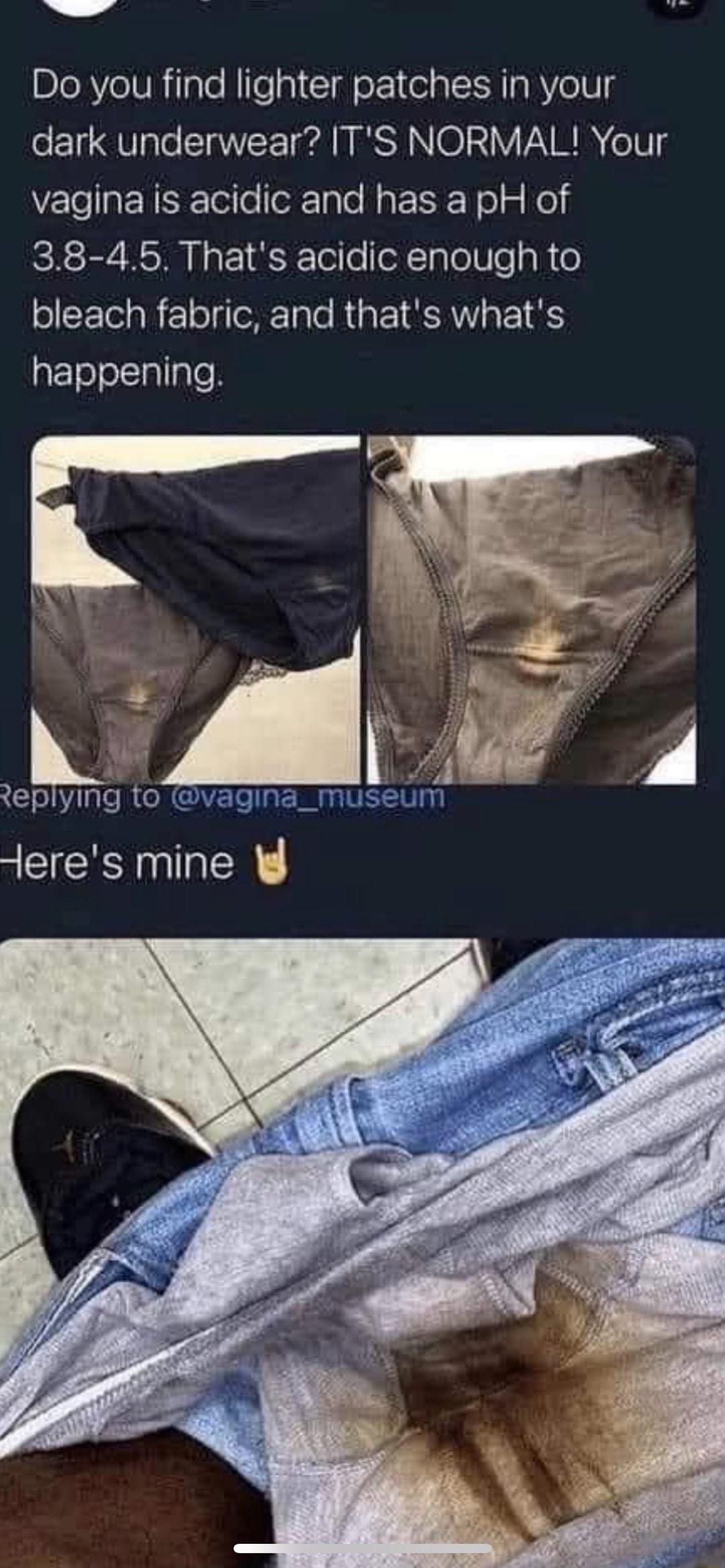 WV Do you find lighter patches in your dark underwear ITS NORMAL Your vagina is acidic and has a pH of RSBV RSHN I a1 F Tol o oXTgToITs R o bleach fabric and thats whats happening eplym CNCIEREN museum Heres mine