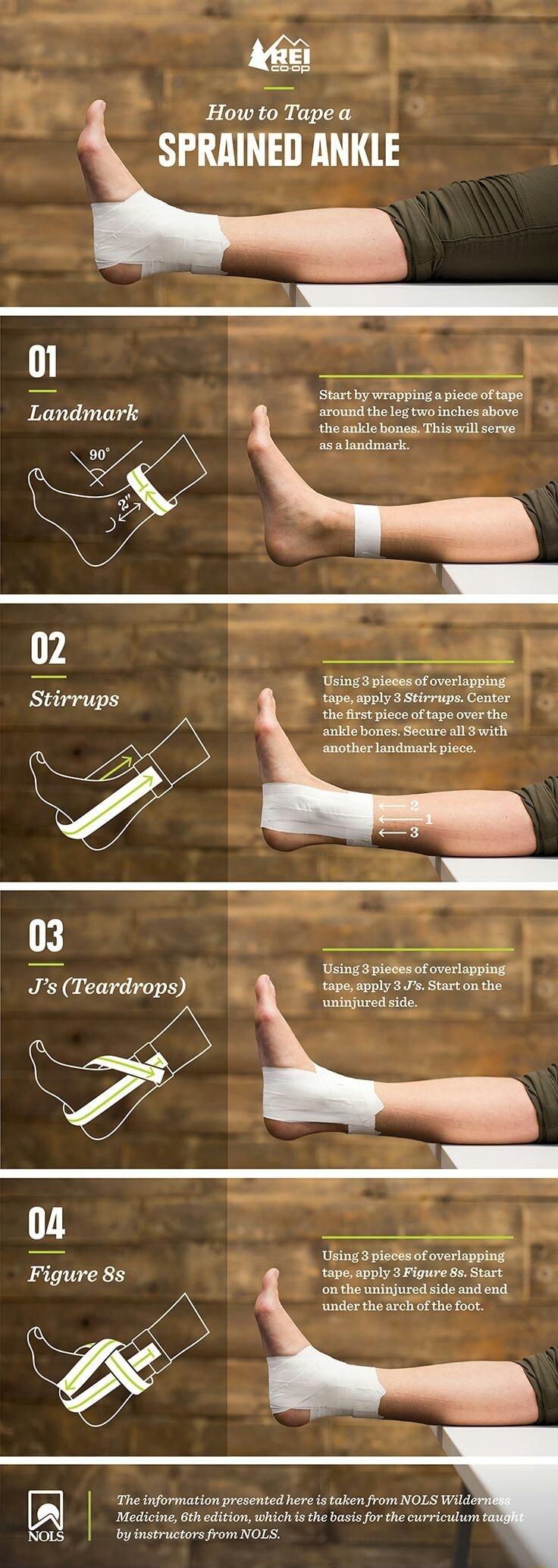 How to Tape a SPRAINED ANKLE Start by wrapping a piece of tape Landmark around the leg two inches above the ankle bones This will serve ECENETGINET S Using3pieces of overlapping Stirrups tape apply 3 Stirrups Center the first piece of tape over the anklebones Secure all 3with anotherlandmark piece Using 3 pieces of overlapping Js Teardrops tape apply 3 J Start on the uninjured side Using 3 pieces 