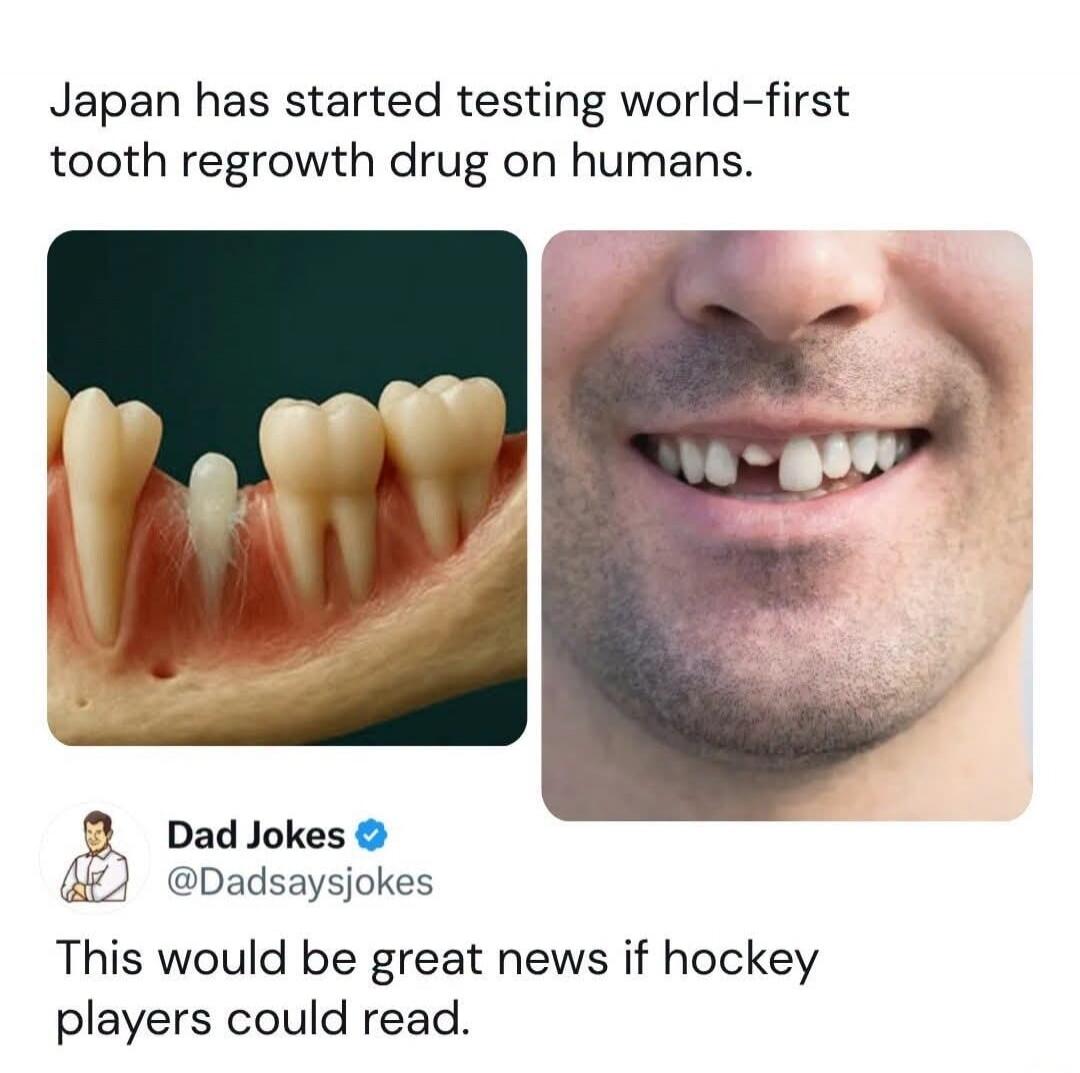 Japan has started testing world-first tooth regrowth drug on humans. Dad Jokes @Dadsaysjokes This would be great news if hockey players could read.