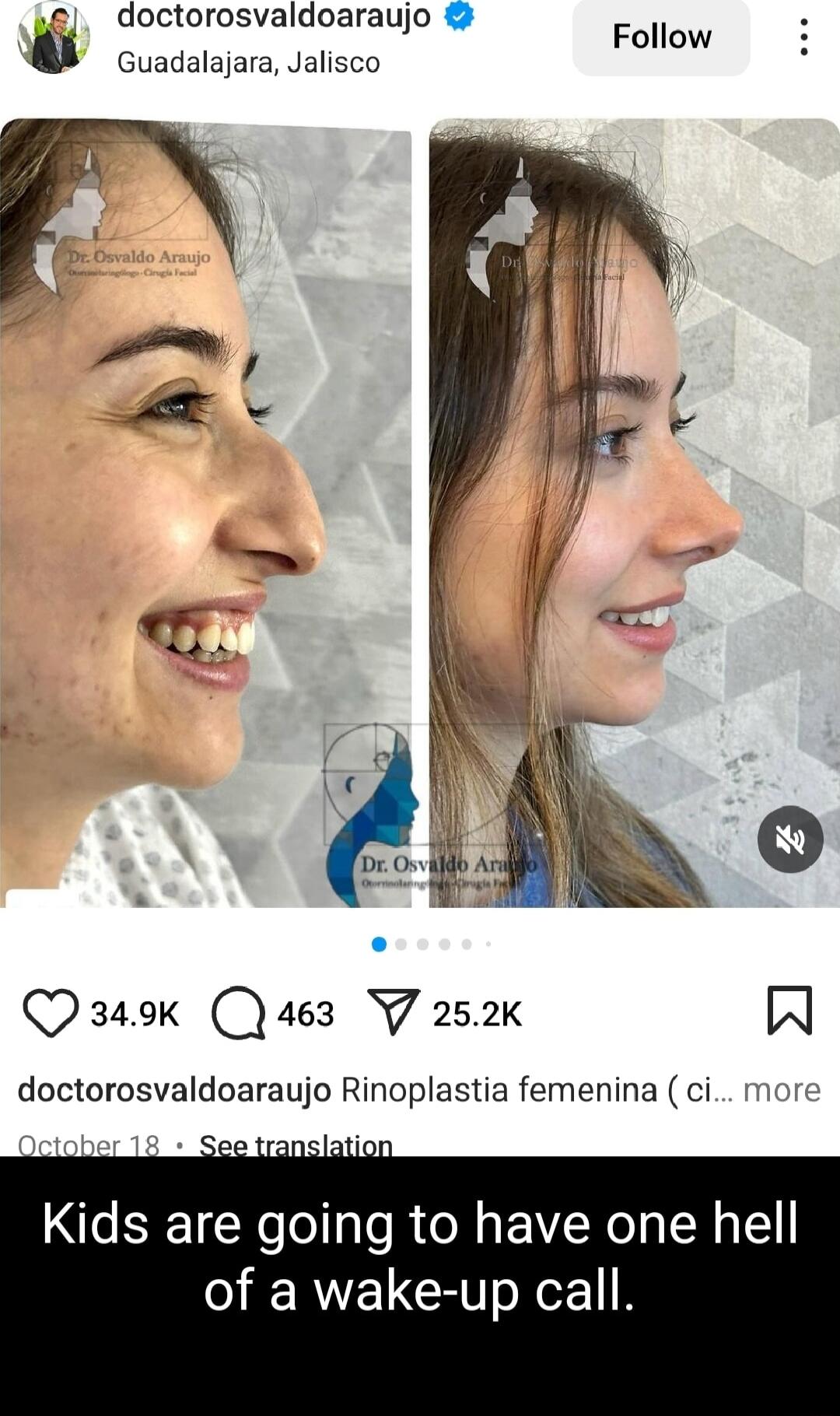 Follow e doctorosvaldoaraujo Coacolsiara salisco Qaok Qas3 Y 252 A doctorosvaldoaraujo Rinoplastia femenina ci Kids are going to have one hell IERIELCET oXeE1R