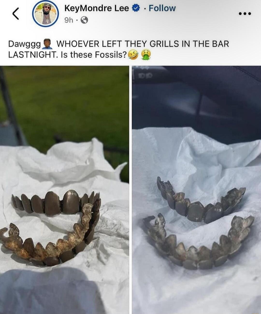 KeyMondre Lee Follow Dawggg WHOEVER LEFT THEY GRILLS IN THE BAR LASTNIGHT Is these Fossils