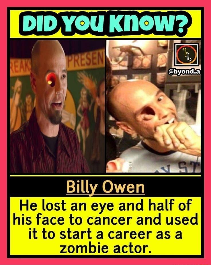 3 Eyu nda Billy Owen He lost an eye and half of his face to cancer and used it to start acareerasa zombie actor