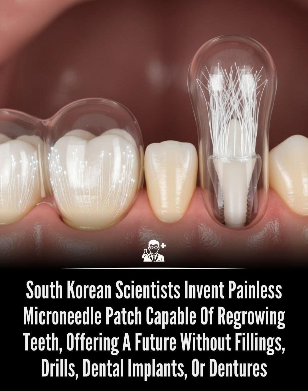 South Korean Scientists Invent Painless Microneedle Patch Capable Of Regrowing Teeth, Offering A Future Without Fillings, Drills, Dental Implants, Or Dentures