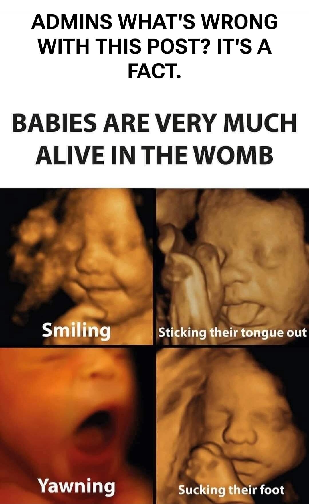 ADMINS WHAT'S WRONG WITH THIS POST? IT'S A FACT. BABIES ARE VERY MUCH ALIVE IN THE WOMB. Smiling, Sticking their tongue out, Yawning, Sucking their foot.