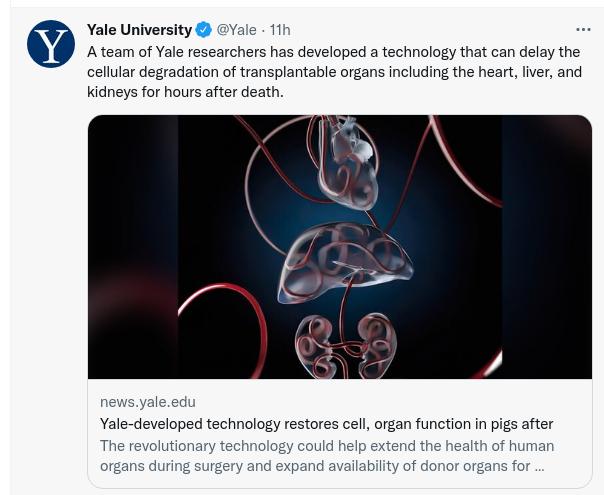 Yale University Yale 11 Ateam of Yale researchers has developed a technology that can delay the callular degradation of transplantable organs including the heart Tver and Kidneys for hours after death Yale developed technology restores cel organ function in pigs after