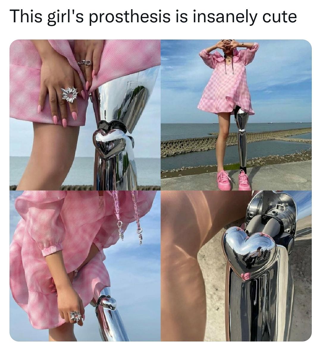 This girls prosthesis is insanely cute