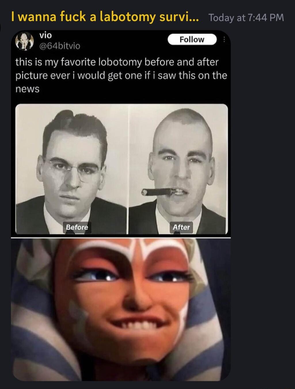 Today at 744 PM this is my favorite lobotomy before and after picture ever i would get one if i saw this on the news