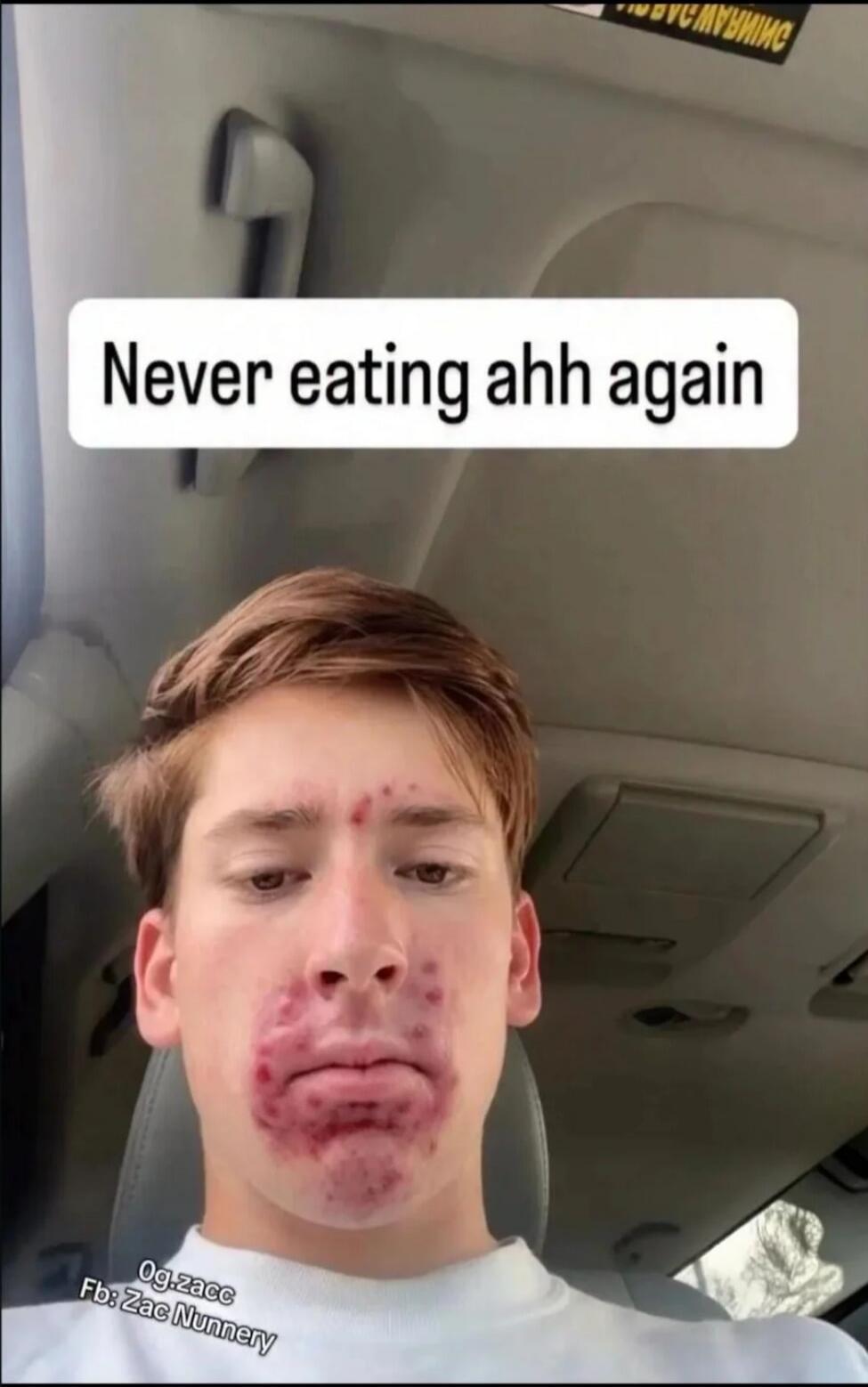 Never eating ahh again Og.zacc Fb: Zac Nunnery